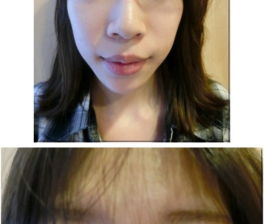 台北雙眼皮,台北雙眼皮推薦,台北雙眼皮ptt,雙眼 皮台北,縫雙眼皮台北,台北縫雙眼皮,台北割雙眼皮 ,割雙眼皮台北,台北縫雙眼皮推薦,台北縫雙眼皮醫 生,台北縫雙眼皮價格,台北縫雙眼皮權威,台北縫雙 眼皮價錢,台北縫雙眼皮評價,台北雙眼皮價格,台北 雙眼皮價錢,台北雙眼皮分享,台北雙眼皮介紹,台北 雙眼皮評價,台北整型推薦,台北釘書針雙眼皮,台北 韓式雙眼皮,台北釘書機雙眼皮,台北訂書針雙眼皮 推薦,台北韓式雙眼皮推薦