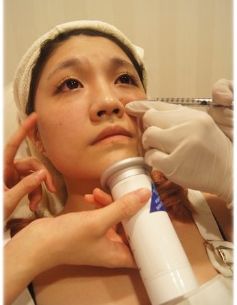 新竹極線音波拉皮,新竹拉皮,新竹拉皮ptt,新竹音波,新竹音波拉皮ptt,新竹音波拉皮,新竹音波拉皮費用,新竹Ulthera音波拉皮,新竹音波拉皮價格,新竹音波拉皮評價,新竹音波拉皮比較,新竹音波拉皮推薦,新竹電波拉皮,新竹音波拉皮美國機,音波拉皮美國機,極限音波拉皮價錢,新竹童顏針,新竹童顏針推薦,新竹舒顏萃價錢,新竹舒顏萃價格,新竹童顏針價錢,新竹童顏針價格