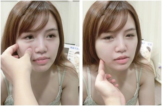 竹東極線音波拉皮,竹東拉皮,竹東拉皮ptt,竹東音波,竹東音波拉皮ptt,竹東音波拉皮,竹東音波拉皮費用,竹東Ulthera音波拉皮,竹東音波拉皮價格,竹東音波拉皮評價,竹東音波拉皮比較,竹東音波拉皮推薦,竹東電波拉皮,竹東音波拉皮美國機,音波拉皮美國機,極限音波拉皮價錢,竹東童顏針,竹東童顏針推薦,竹東舒顏萃價錢,竹東舒顏萃價格,竹東童顏針價錢,竹東童顏針價格