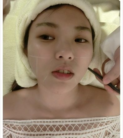 竹東極線音波拉皮,竹東拉皮,竹東拉皮ptt,竹東音波,竹東音波拉皮ptt,竹東音波拉皮,竹東音波拉皮費用,竹東Ulthera音波拉皮,竹東音波拉皮價格,竹東音波拉皮評價,竹東音波拉皮比較,竹東音波拉皮推薦,竹東電波拉皮,竹東音波拉皮美國機,音波拉皮美國機,極限音波拉皮價錢,竹東童顏針,竹東童顏針推薦,竹東舒顏萃價錢,竹東舒顏萃價格,竹東童顏針價錢,竹東童顏針價格