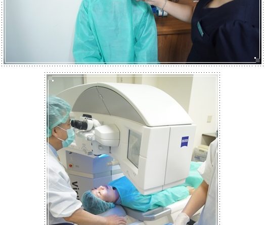 TransPRK,七次元近視雷射,竹東眼科,竹東眼科推 薦,竹東眼科診所,竹東眼科權威,竹東眼科醫師,竹東近視雷射,近視雷射竹東,竹東雷射近視,雷射近視 竹東,竹東雷射近視推薦,竹東雷射近視手術,竹東近 視雷射診所,竹東近視雷射費用,竹東近視雷射醫師, 竹東近視雷射推薦,竹東近視雷射手術,竹東近視雷 射評價,竹東近視雷射價格,竹東近視雷射價錢,竹東 近視雷射後遺症,竹東眼科推薦ptt,竹東近視雷射推 薦ptt