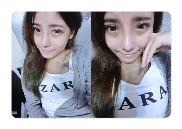 竹東墊下巴,墊下巴手術,墊下巴竹東,竹東整型推薦 ,竹東整型手術,卡麥拉墊下巴竹東,竹東卡麥拉墊下 巴,卡麥拉墊下巴竹東,竹東卡麥拉墊下巴推薦,竹東 卡麥拉墊下巴評論,竹東卡麥拉墊下巴價格,竹東卡 麥拉墊下巴比較,竹東卡麥拉墊下巴價錢,竹東卡麥 拉墊下巴評價,竹東卡麥拉墊下巴介紹,竹東卡麥拉 墊下巴分享,竹東墊下巴價格,竹東墊下巴推薦,竹東 墊下巴評論,竹東墊下巴比較,竹東墊下巴價錢,竹東 墊下巴分享,竹東墊下巴介紹,竹東墊下巴評價