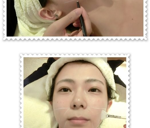 中壢極線音波拉皮,中壢拉皮,中壢拉皮ptt,中壢音波,中壢音波拉皮ptt,中壢音波拉皮,中壢音波拉皮費用,中壢Ulthera音波拉皮,中壢音波拉皮價格,中壢音波拉皮評價,中壢音波拉皮比較,中壢音波拉皮推薦,中壢電波拉皮,中壢音波拉皮美國機,音波拉皮美國機,極限音波拉皮價錢,中壢童顏針,中壢童顏針推薦,中壢舒顏萃價錢,中壢舒顏萃價格,中壢童顏針價錢,中壢童顏針價格