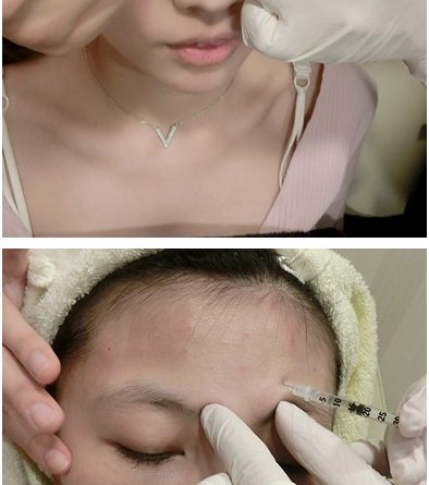 新北醫美,新北微整,新北醫美ptt,新北微整ptt,新北醫美推薦ptt,新北整形外科,新北醫美推薦,新北醫美診所,新北玻尿酸,新北打玻尿酸,新北玻尿酸推薦,新北肉毒,新北打肉毒,新北肉毒推薦,新北肉毒桿菌,新北醫美價格,新北醫美評價,新北醫美價錢,新北玻尿酸價格,新北玻尿酸評價,新北玻尿酸介紹,新北玻尿酸價錢,新北玻尿酸評論,新北肉毒價格,新北肉毒評價,新北肉毒介紹,新北肉毒價錢,新北整形外科,新北醫美推薦,新北玻尿酸價格,玻尿酸整型新北,新北肉毒微整 