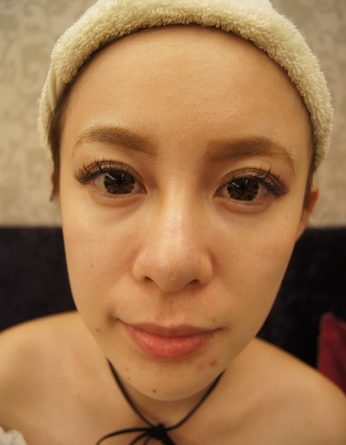 新北醫美,新北微整,新北醫美ptt,新北微整ptt,新北醫美推薦ptt,新北整形外科,新北醫美推薦,新北醫美診所,新北玻尿酸,新北打玻尿酸,新北玻尿酸推薦,新北肉毒,新北打肉毒,新北肉毒推薦,新北肉毒桿菌,新北醫美價格,新北醫美評價,新北醫美價錢,新北玻尿酸價格,新北玻尿酸評價,新北玻尿酸介紹,新北玻尿酸價錢,新北玻尿酸評論,新北肉毒價格,新北肉毒評價,新北肉毒介紹,新北肉毒價錢,新北整形外科,新北醫美推薦,新北玻尿酸價格,玻尿酸整型新北,新北肉毒微整