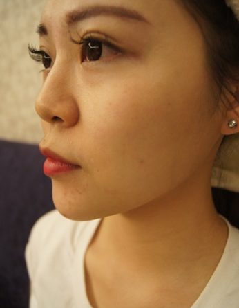 新北醫美,新北微整,新北醫美ptt,新北微整ptt,新北醫美推薦ptt,新北整形外科,新北醫美推薦,新北醫美診所,新北玻尿酸,新北打玻尿酸,新北玻尿酸推薦,新北肉毒,新北打肉毒,新北肉毒推薦,新北肉毒桿菌,新北醫美價格,新北醫美評價,新北醫美價錢,新北玻尿酸價格,新北玻尿酸評價,新北玻尿酸介紹,新北玻尿酸價錢,新北玻尿酸評論,新北肉毒價格,新北肉毒評價,新北肉毒介紹,新北肉毒價錢,新北整形外科,新北醫美推薦,新北玻尿酸價格,玻尿酸整型新北,新北肉毒微整 