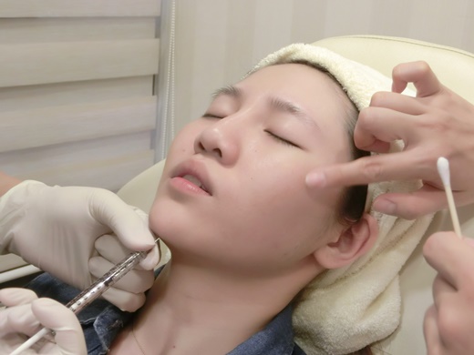 新北醫美,新北微整,新北醫美ptt,新北微整ptt,新北醫美推薦ptt,新北整形外科,新北醫美推薦,新北醫美診所,新北玻尿酸,新北打玻尿酸,新北玻尿酸推薦,新北肉毒,新北打肉毒,新北肉毒推薦,新北肉毒桿菌,新北醫美價格,新北醫美評價,新北醫美價錢,新北玻尿酸價格,新北玻尿酸評價,新北玻尿酸介紹,新北玻尿酸價錢,新北玻尿酸評論,新北肉毒價格,新北肉毒評價,新北肉毒介紹,新北肉毒價錢,新北整形外科,新北醫美推薦,新北玻尿酸價格,玻尿酸整型新北,新北肉毒微整