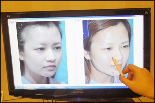 彰化童顏針推薦