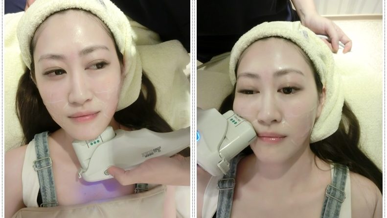 基隆童顏針推薦