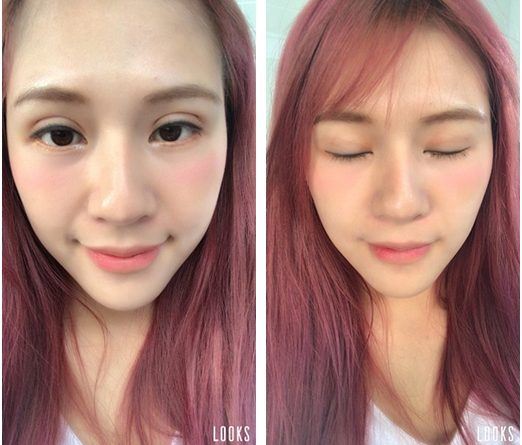 基隆縫雙眼皮醫生