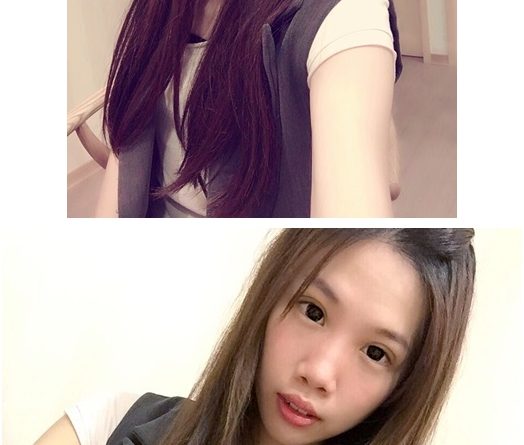 基隆縫雙眼皮醫生