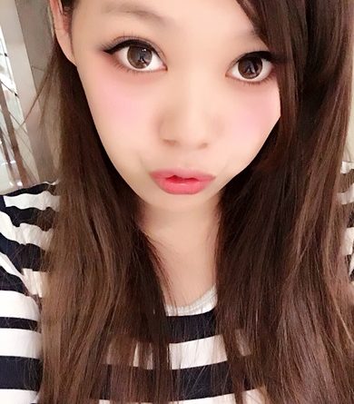 彰化雙眼皮推薦