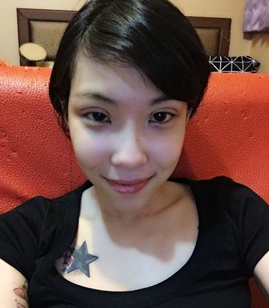 基隆縫雙眼皮醫生