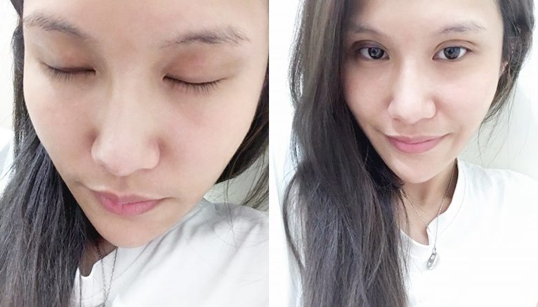 基隆縫雙眼皮醫生