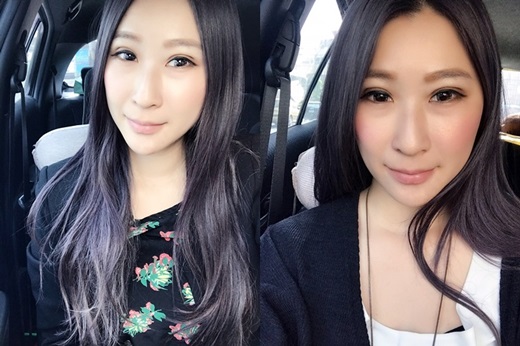 基隆縫雙眼皮醫生