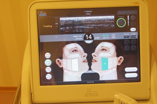 南投童顏針推薦