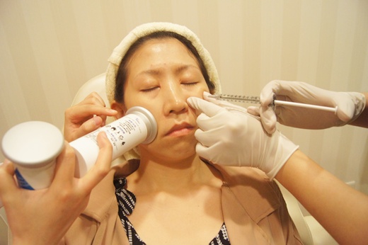 基隆童顏針推薦