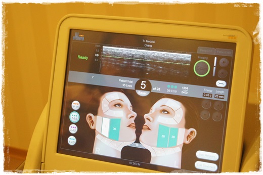 基隆童顏針推薦