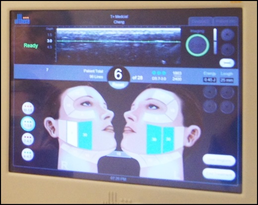 彰化童顏針推薦