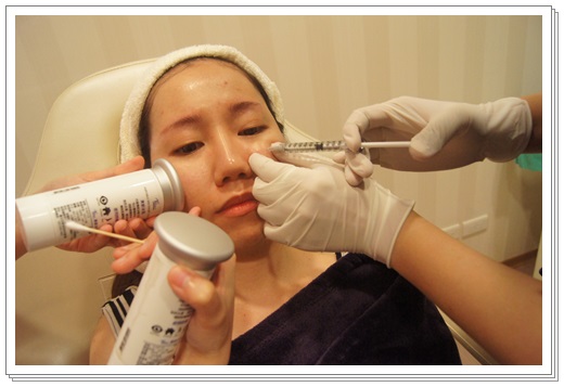 彰化童顏針推薦