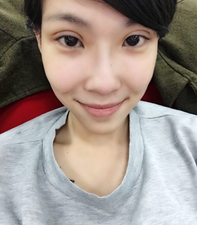 彰化雙眼皮推薦