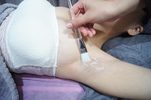 宜蘭腋下除毛