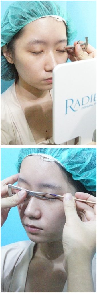台北韓系割訂書針雙眼皮推薦醫師