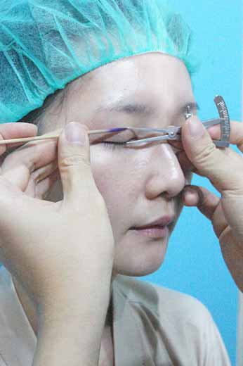 台北韓系自然縫雙眼皮診所醫師推薦