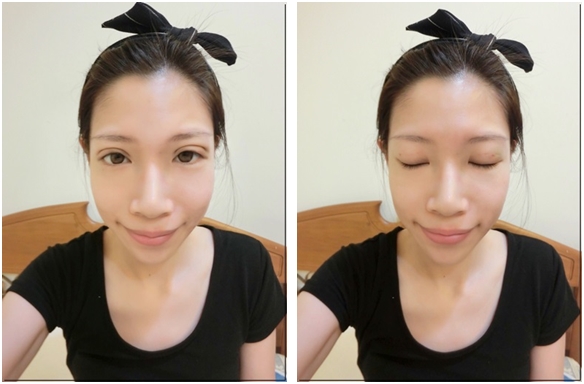台北韓系自然縫雙眼皮診所推薦